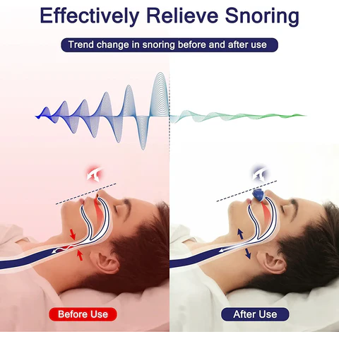 Cpap-Maskiner Kompakt Stillegende Rechargeable Micro Cpap Device For Snoring - Image 4