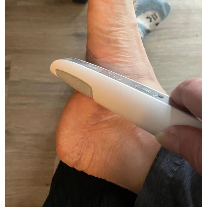 Electric Foot Callus Remover With USB Rechargeable Design Gently Buffs Away Dry Cracked Skin - Image 16