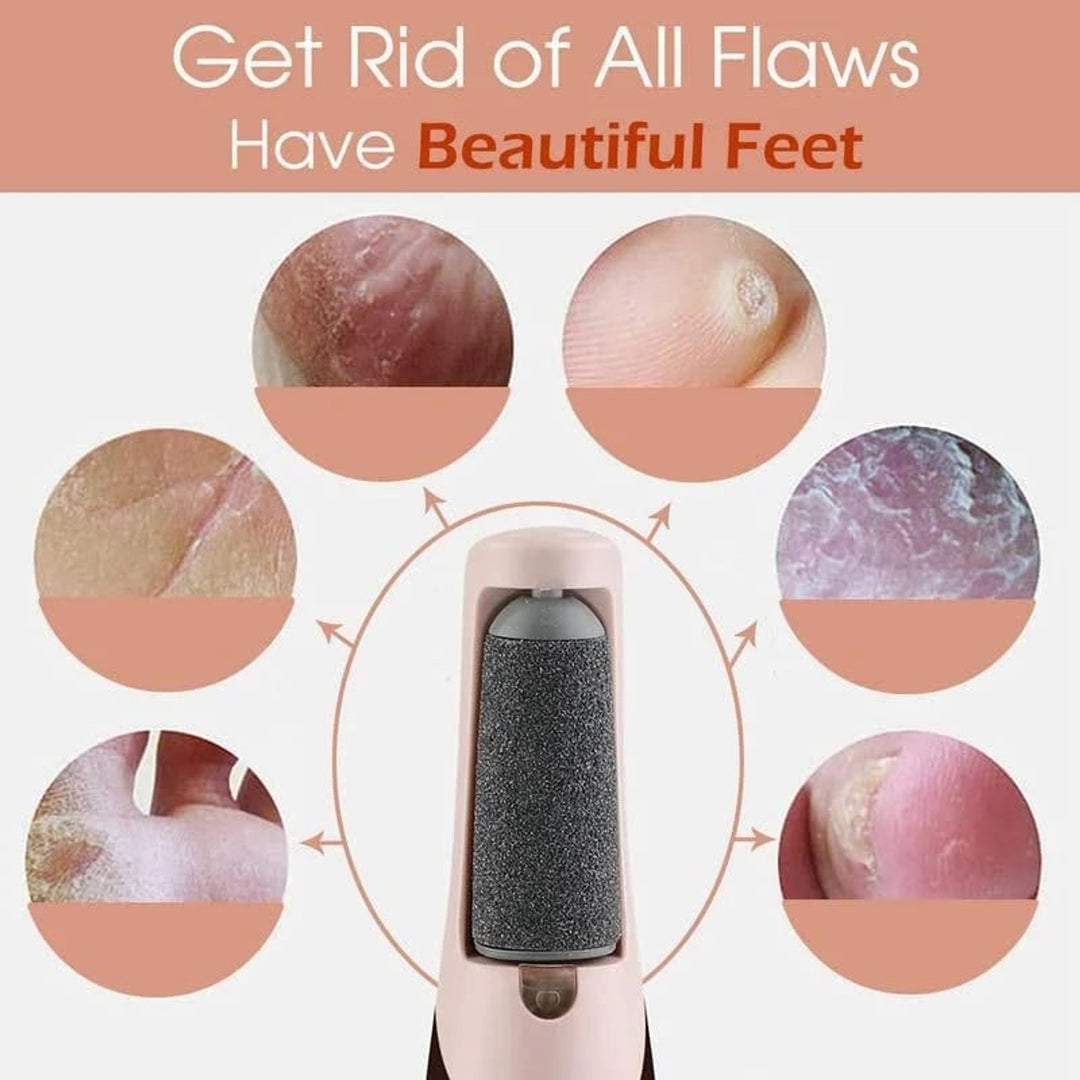 Electric Foot Callus Remover With USB Rechargeable Design Gently Buffs Away Dry Cracked Skin - Image 17