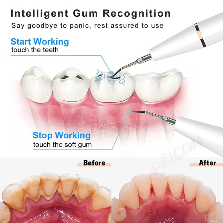 Electric Teeth Cleaner With LED Screen 3 Modes USB Rechargeable - Image 3