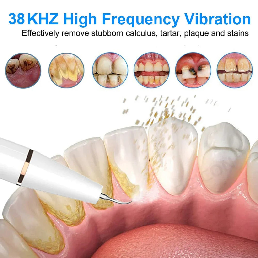 Electric Teeth Cleaner With LED Screen 3 Modes USB Rechargeable - Image 2