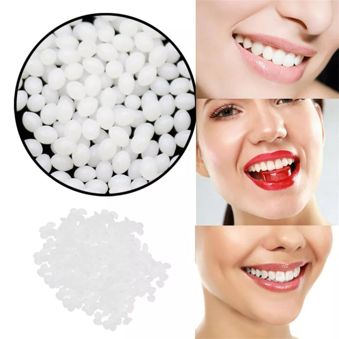 Moldable False Teeth Kit Reusable Diy Non-Toxic Polymer Beads For Teeth Repair - Image 6