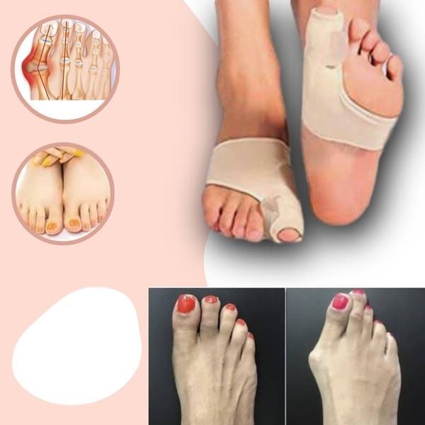 Orthopedic Toe Bunion Corrector For Pain Relief And Toe Alignment - Image 1