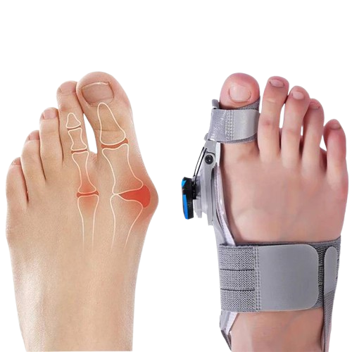 Toe Spacer Bunion Corrector With Hinge And Adjustable Knob For Night Use - Image 1