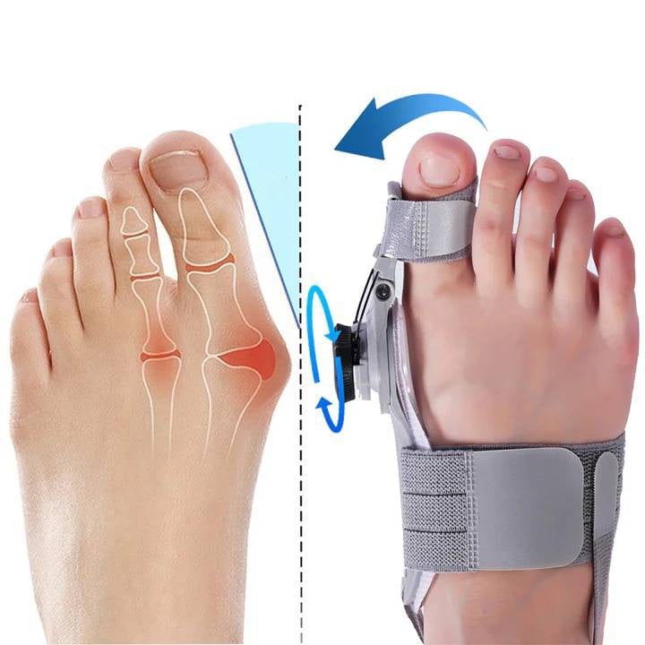 Toe Spacer Bunion Corrector With Hinge And Adjustable Knob For Night Use - Image 2
