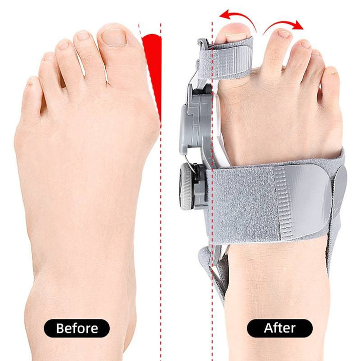 Toe Spacer Bunion Corrector With Hinge And Adjustable Knob For Night Use - Image 4